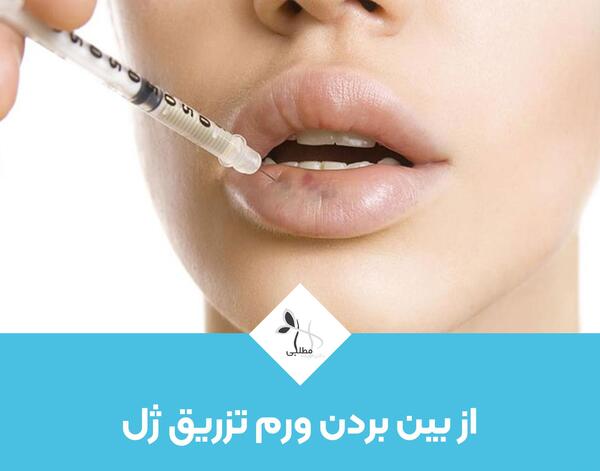 عکس ورم صورت بعد از تزریق ژل