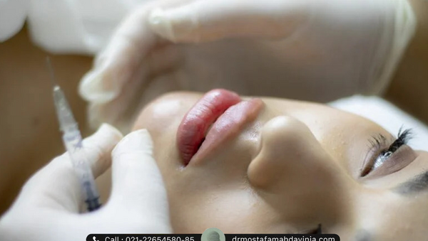 عکس ورم صورت بعد از تزریق ژل