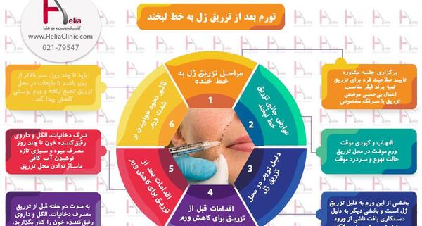عکس ورم صورت بعد از تزریق ژل