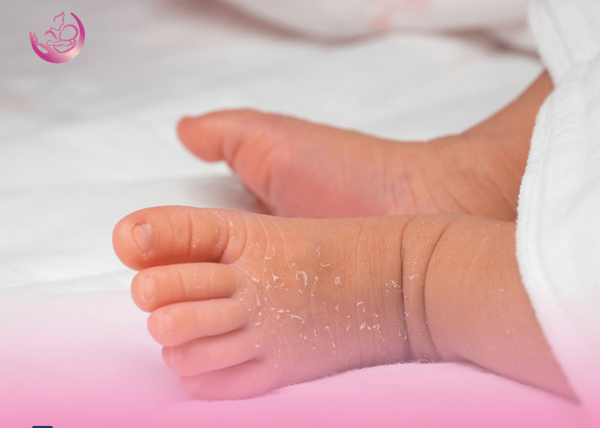 عفونت قارچي عکس حساسیت نوزاد به پوشک