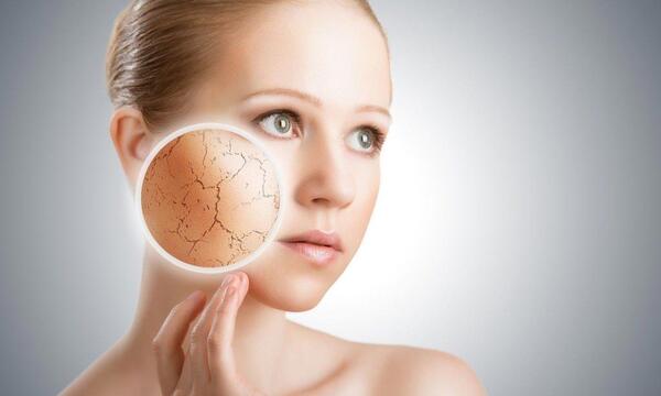 عکس نوزاد ایکتیوز