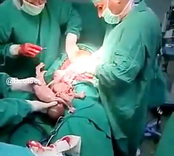 عکس نوزاد نه ماهه در شکم مادر