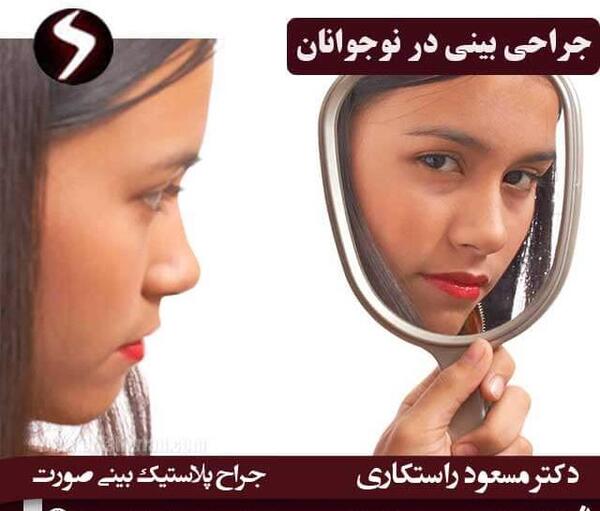 عکس جراحی زیبایی دختر 15 ساله