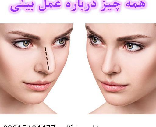 عکس جراحی زیبایی دختر 15 ساله