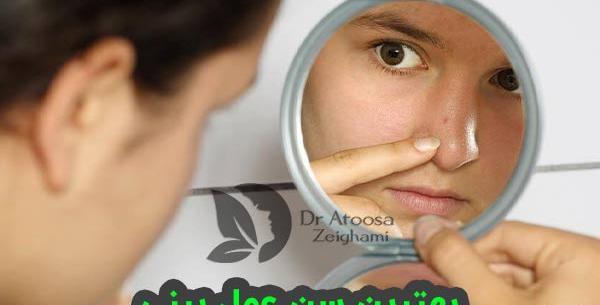 عکس جراحی زیبایی دختر 15 ساله