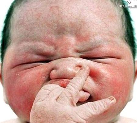 عکس نوزاد زشت دختر