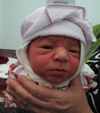 عکس نوزاد زشت دختر