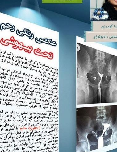 عکس سفید کوه خرم آباد