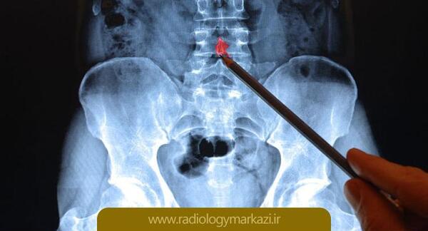 عکس رادیولوژی