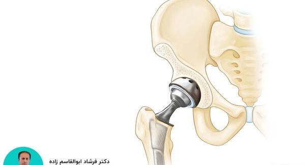 عکس سیاه شدن استخوان پا