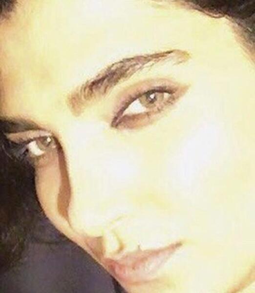 عکس سارا رسول زاده قبل از عمل
