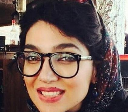 عکس سارا رسول زاده قبل از عمل