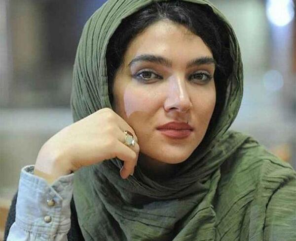 عکس سارا رسول زاده قبل از عمل