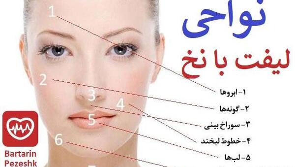 عکسهای لیفت صورت با نخ