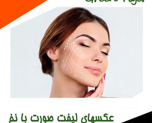 عکسهای لیفت صورت با نخ