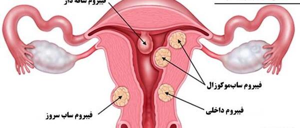 عکس بافت رحم