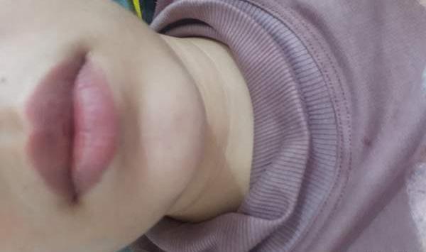 عکس ژل لب نی نی سایت