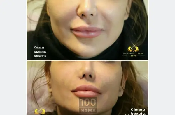 عکس ژل لب نی نی سایت