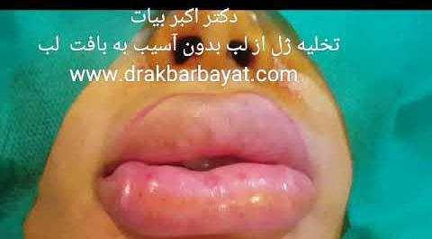عکس ژل لب نی نی سایت
