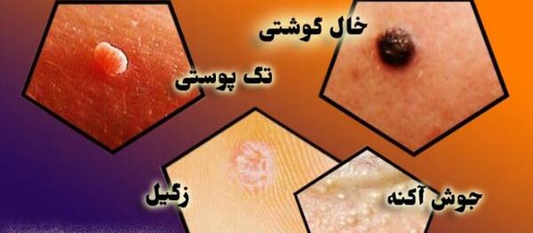 عکس جوش واژن نی نی سایت