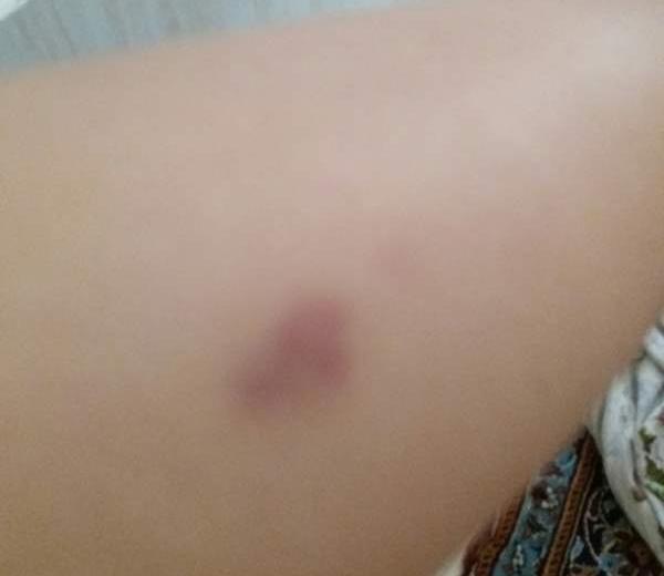 عکس سوتی کبودی نی نی سایت