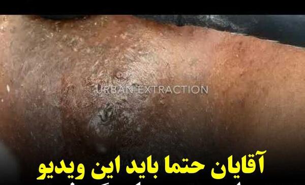 عکس اونجاتون نی نی سایت