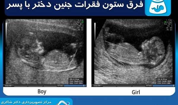 عکس جمجمه پسر نی نی سایت