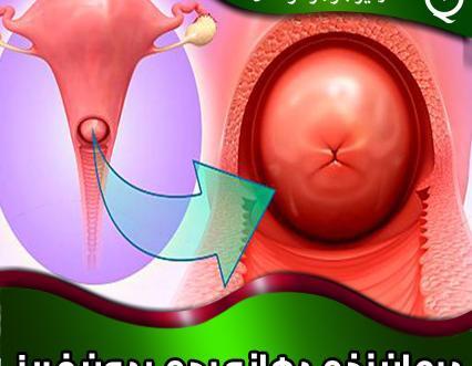 عکس زخم دهانه رحم نی نی سایت