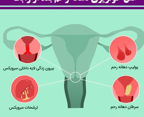 عکس زخم دهانه رحم نی نی سایت