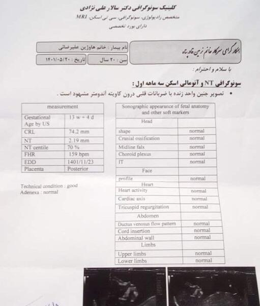 عکس غربالگری دوم نی نی سایت