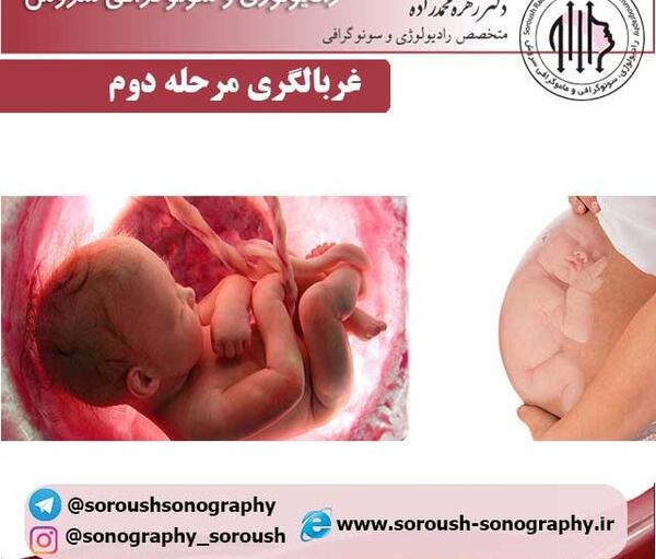 عکس غربالگری دوم نی نی سایت