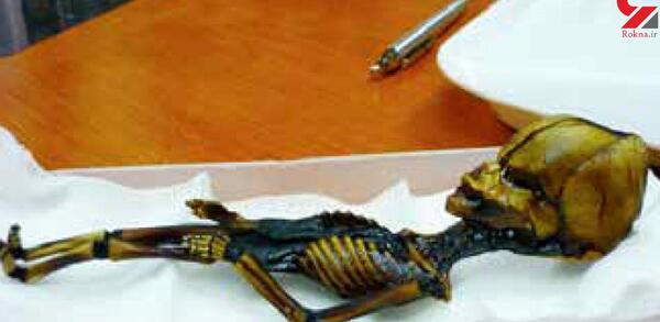 عکس اسکلت واقعی در ایران
