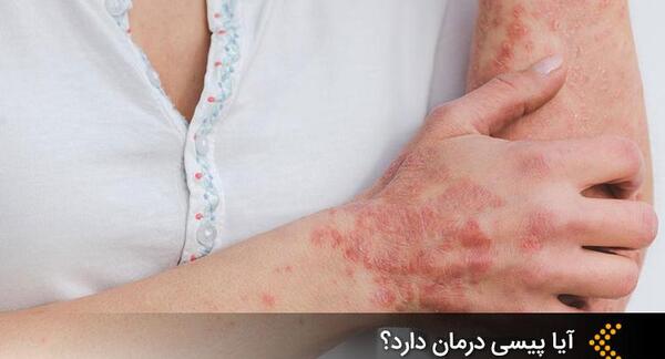 عکس پیسی نی نی سایت