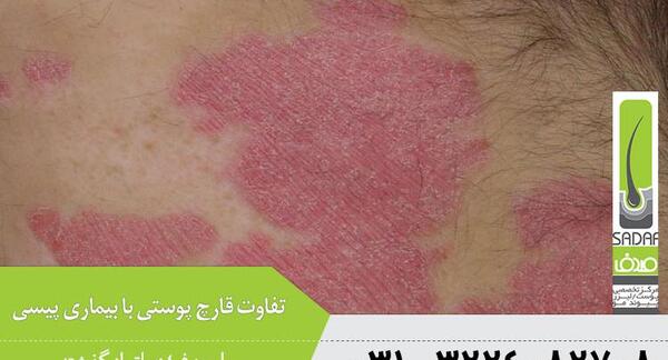 عکس پیسی نی نی سایت