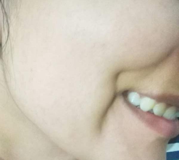 عکس پوست صورتتون نی نی سایت