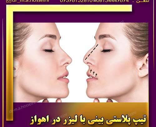 عکس چربی سوزی دماغ