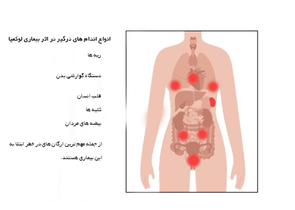 عکس در مورد سرطان