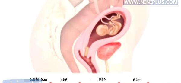 عکس توی شکم مادر