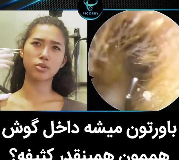 عکس توی گوش واقعی
