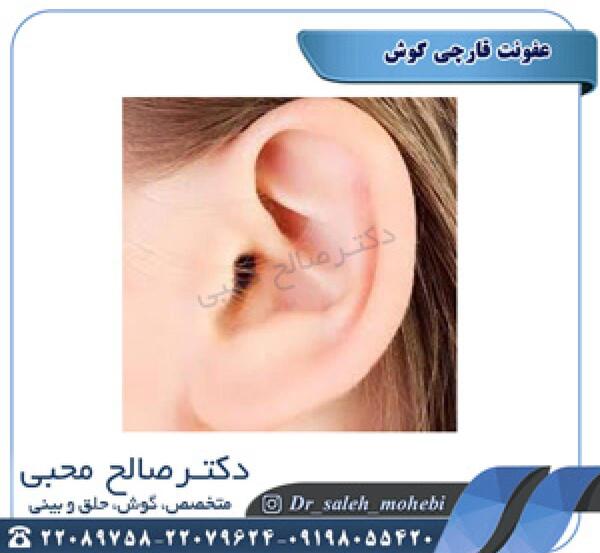 عکس توی گوش واقعی