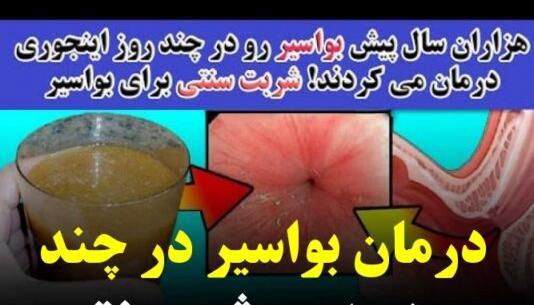 عکس بواسیر