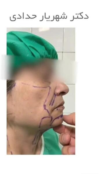 عکس دکتر شهریار حدادی