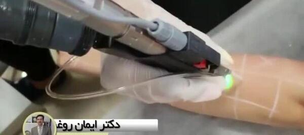عکس دستگاه لیزر دکا