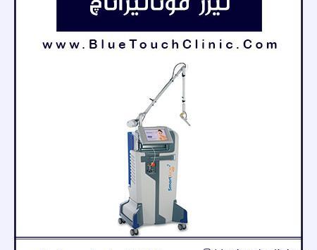 عکس دستگاه لیزر مونالیزا