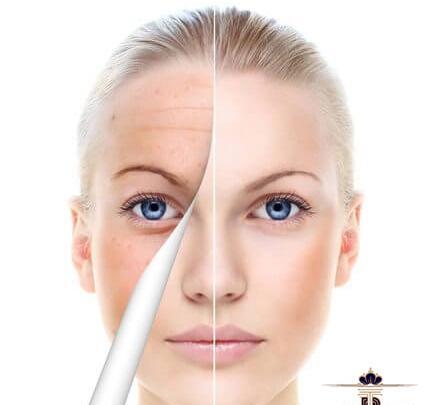 عکس دستگاه لیزر مونالیزا