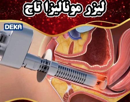 عکس دستگاه لیزر مونالیزا