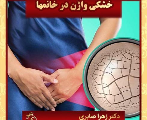 عکس دستگاه لیزر مونالیزا