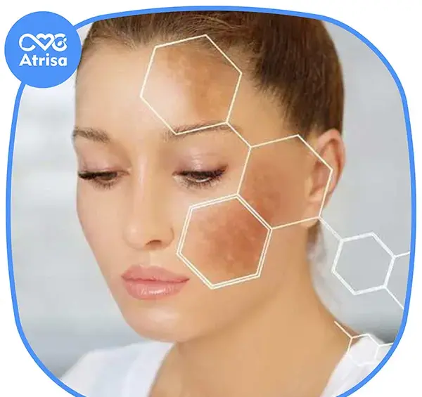 عکس دستگاه لیزر کیوسوئیچ