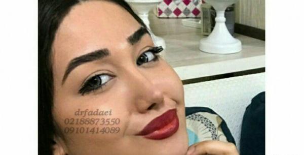 عکس دستگاه لیزر کوترا