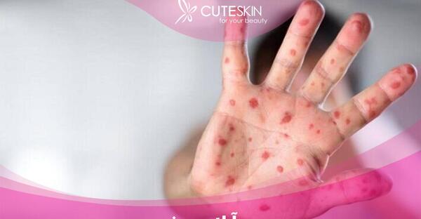 عکس ابله میمون چگونه است